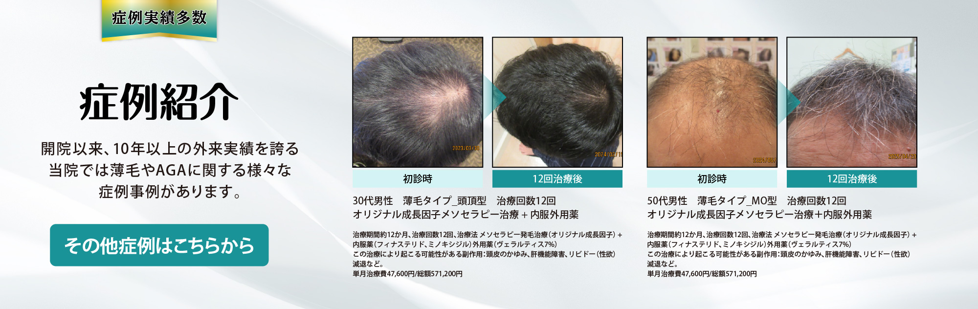 症例紹介